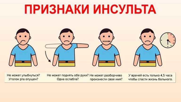 Инфаркт миокарда. Первая помощь и алгоритм действий. ОНМК. Признаки инсульта